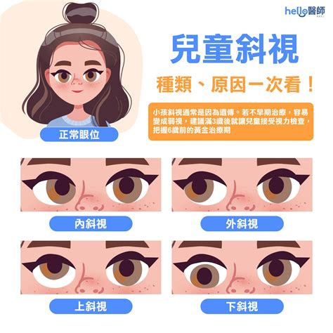 鬥雞眼做愛